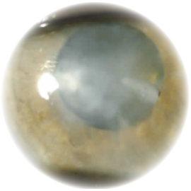 cornea1