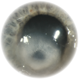 cornea2